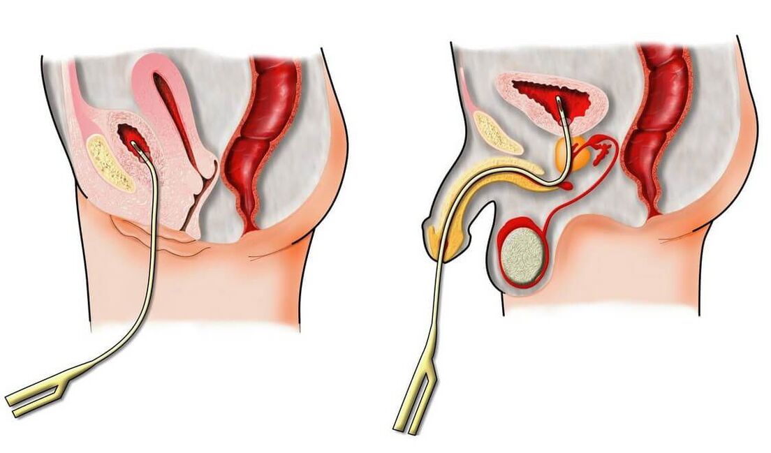 male impotence diagnosis